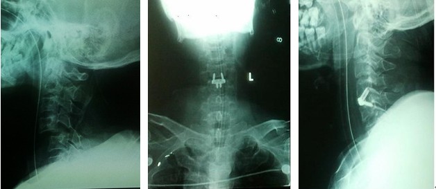脊柱外科